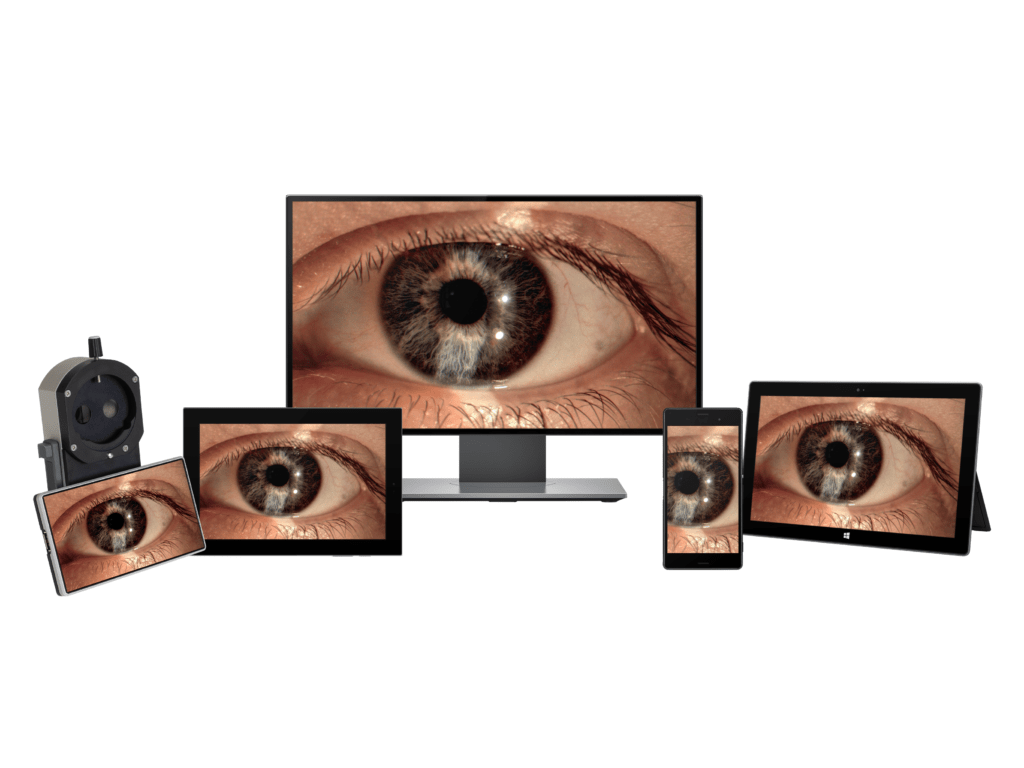 Frey Eyemager application remote control of digital imaging system SLI-200