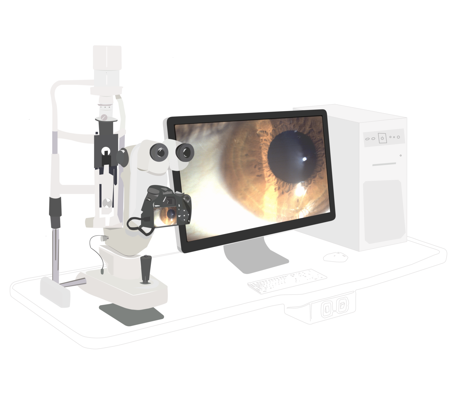 Digital slit lamps are essential for ophthalmic practice.